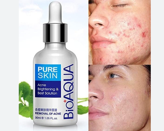 Suero pure skin Anti acné Bioaqua