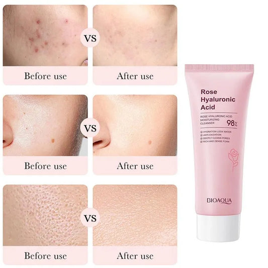Jabon de Rosas y Acido Hialuronico Bioaqua